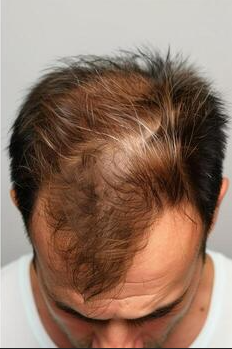 After treatment results