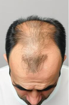 Before treatment